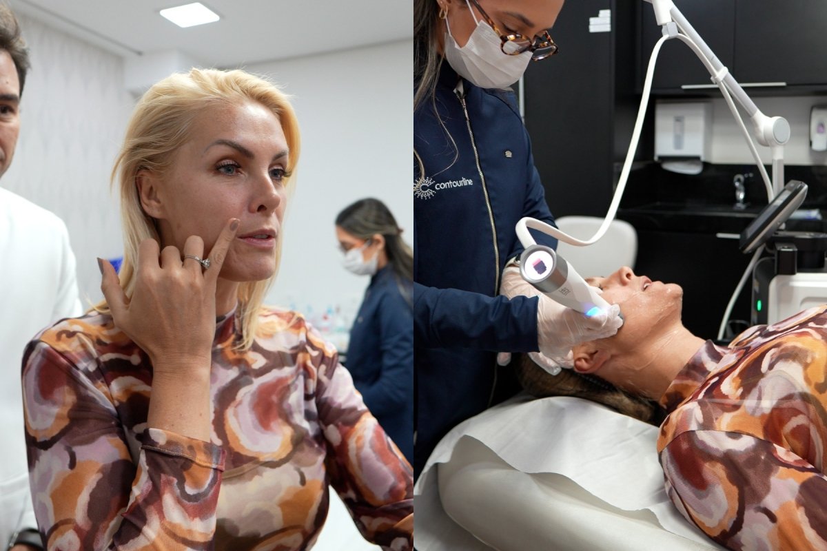 Ana Hickmann faz procedimento estético antes de casamento com Edu Guedes