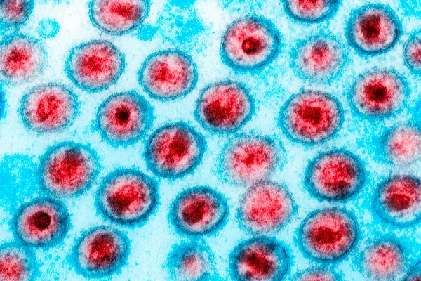 feed-image-1788621737 Medicamento de câncer reduz células infectadas por HIV em estudo
