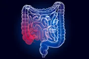 feed-image-1788883338-3 Médica alerta quando gases e inchaço abdominal devem ser investigados