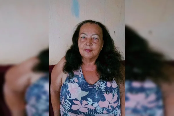 feed-image-1788943924 Após esperar na chuva por maca, idosa morre em hospital no Entorno do DF