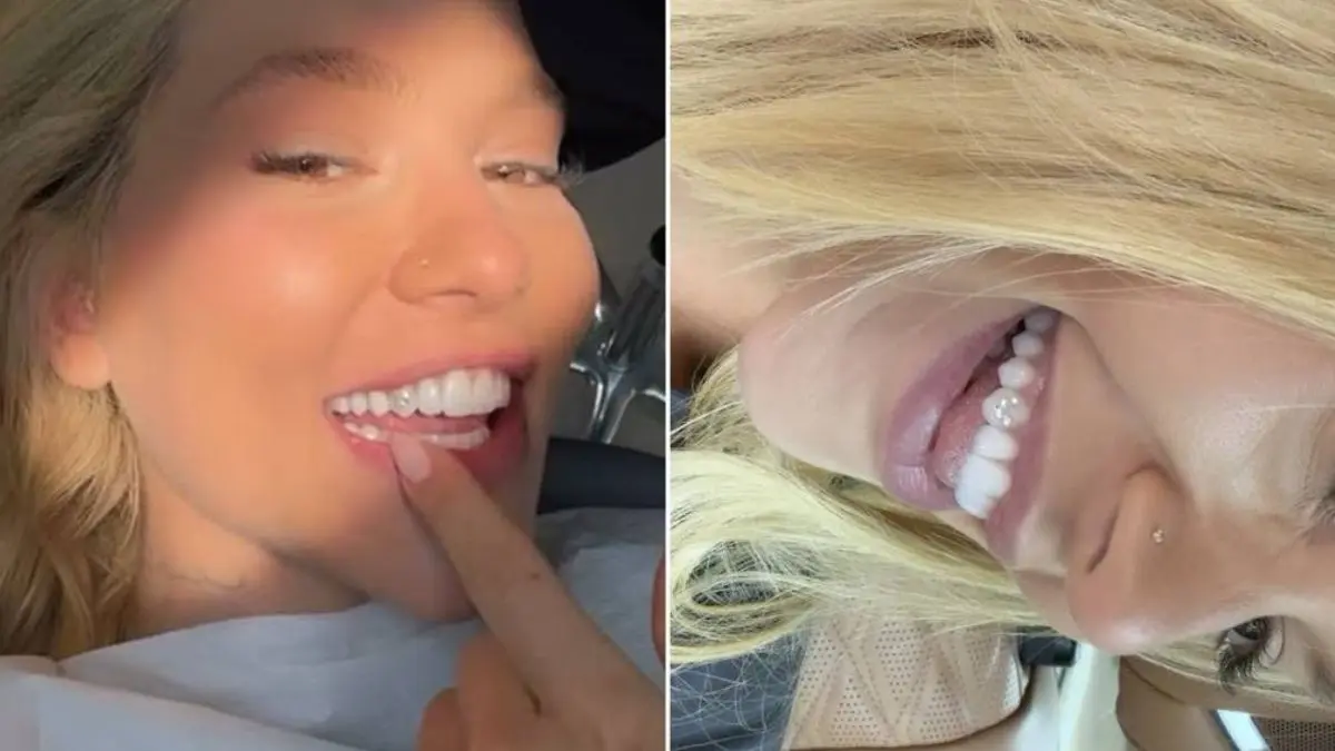 feed-image-1789066863 Diamante no dente: joia colocada por Virginia pode acumular sujeira e resultar em formação de placa