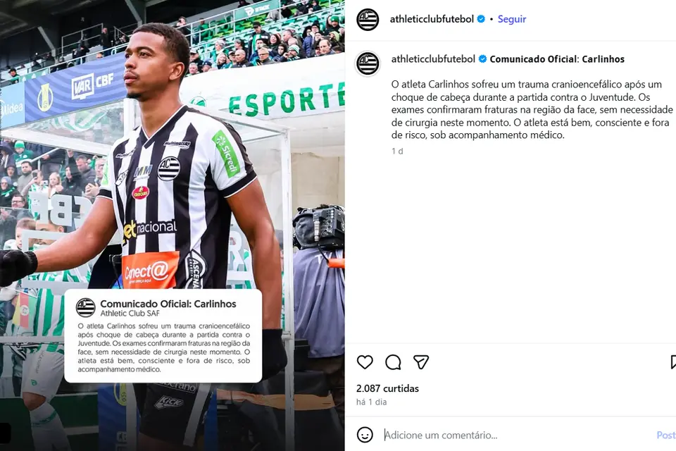 feed-image-1789479159 Ex-Vila, Carlinhos sofre mesmo traumatismo de Helton Leite