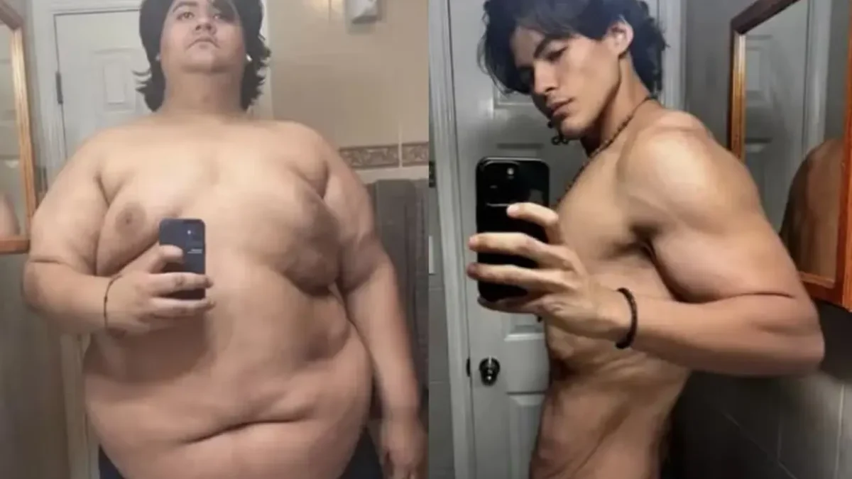Jovem perde 124 quilos sem cirurgia nem caneta emagrecedora; veja como