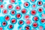 Medicamento de câncer reduz células infectadas por HIV em estudo