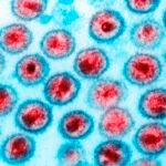 Medicamento de câncer reduz células infectadas por HIV em estudo