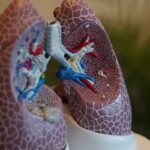 Microplásticos são mais frequentes em pulmões de pacientes com câncer