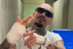 Streamer tem dedo amputado ao tentar invadir Rock in Rio pulando grade; vídeo