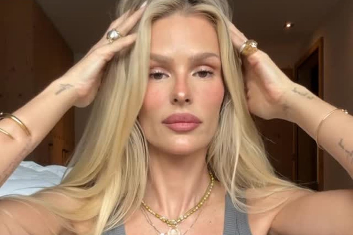 Yasmin Brunet exibe marcas do lipedema e relata dor e queimação