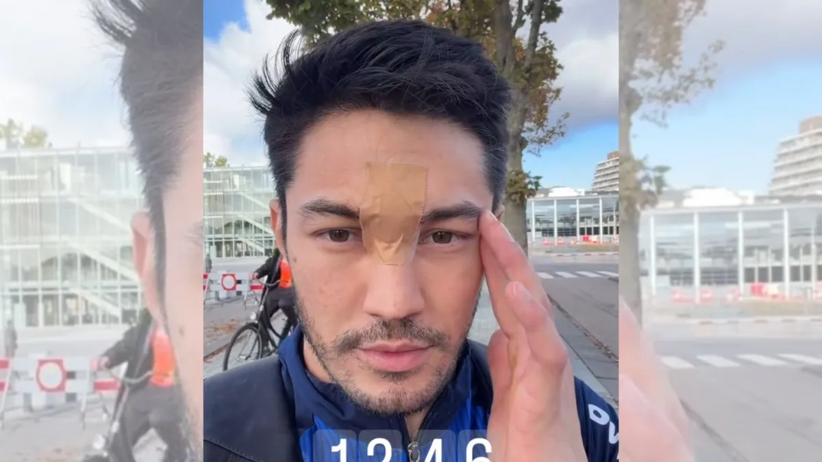 Arthur Nory sofre acidente e bate a cabeça na barra no Mundial de Ginástica