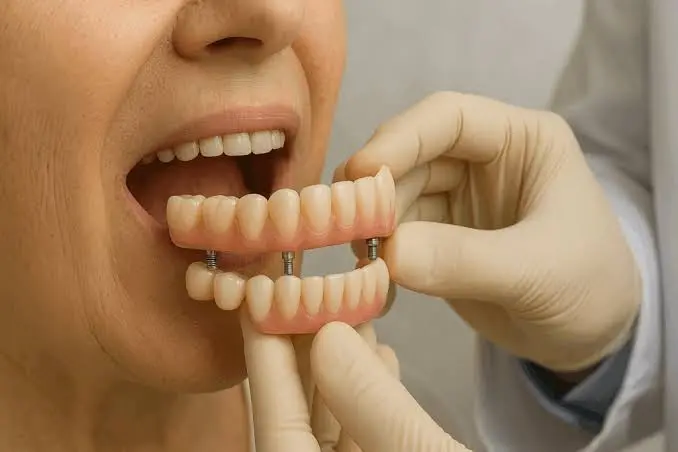 Dentadura de graça pelo SUS: cidade de Goiás entrega 4,7 mil próteses; veja como conseguir