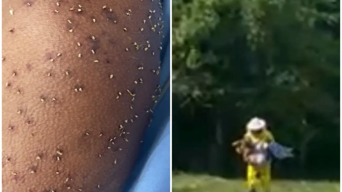 Homem é atacado por enxame de abelhas na zona rural de Itapuranga