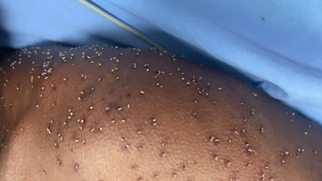Homem é encontrado inconsciente após levar mais de 500 picadas de abelhas em Itapuranga