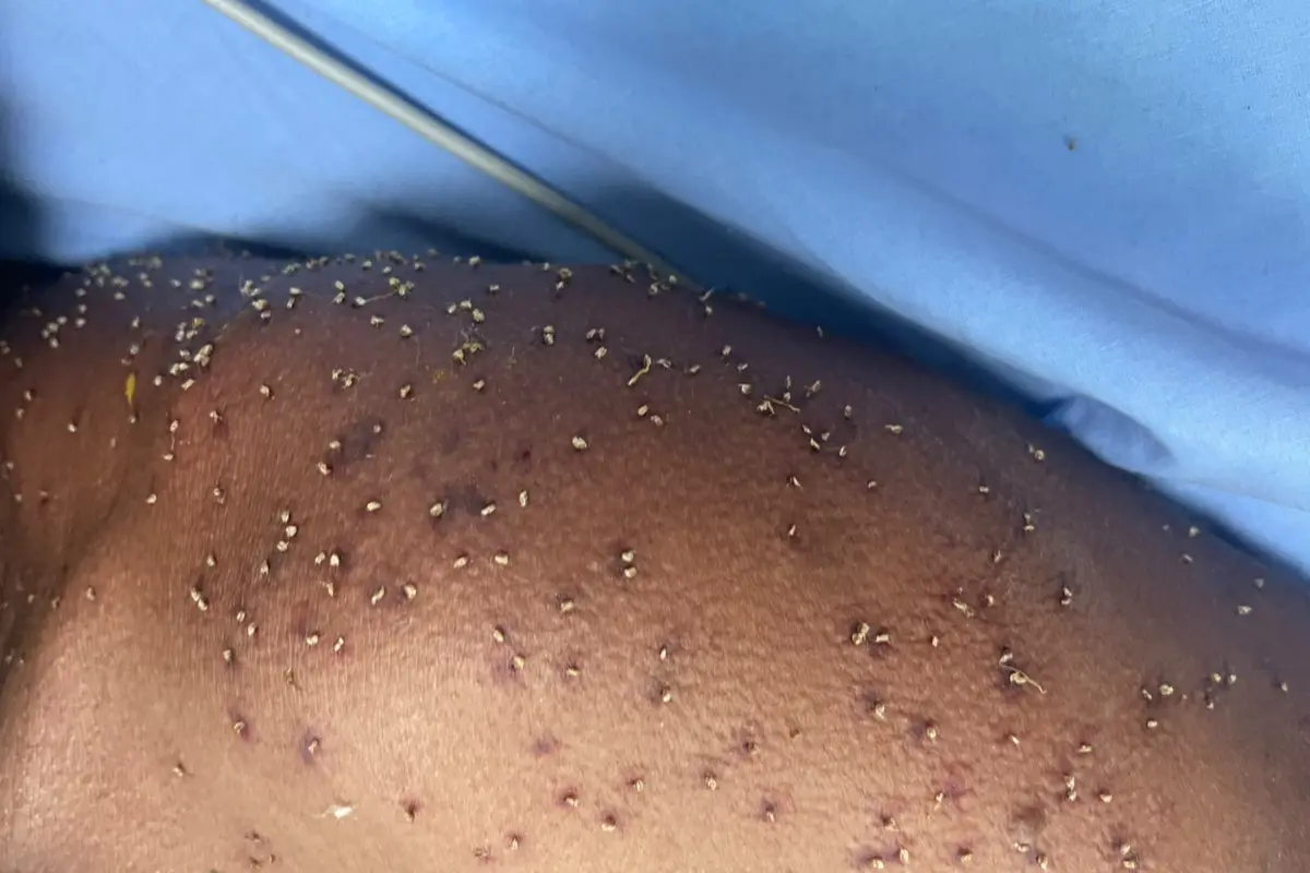 Homem é encontrado inconsciente após levar mais de 500 picadas de abelhas em Itapuranga