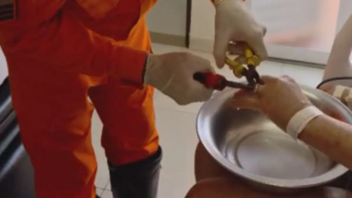 Mulher com aliança presa no dedo é salva pelo Corpo de Bombeiros em Jataí