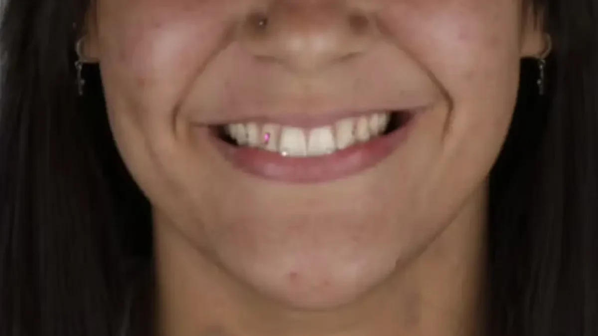 Mulher é presa após sair sem pagar por cristais nos dentes em Trindade