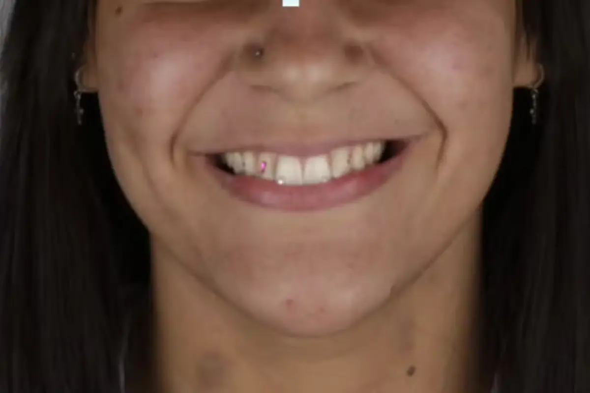 Mulher é presa após sair sem pagar por cristais nos dentes em Trindade
